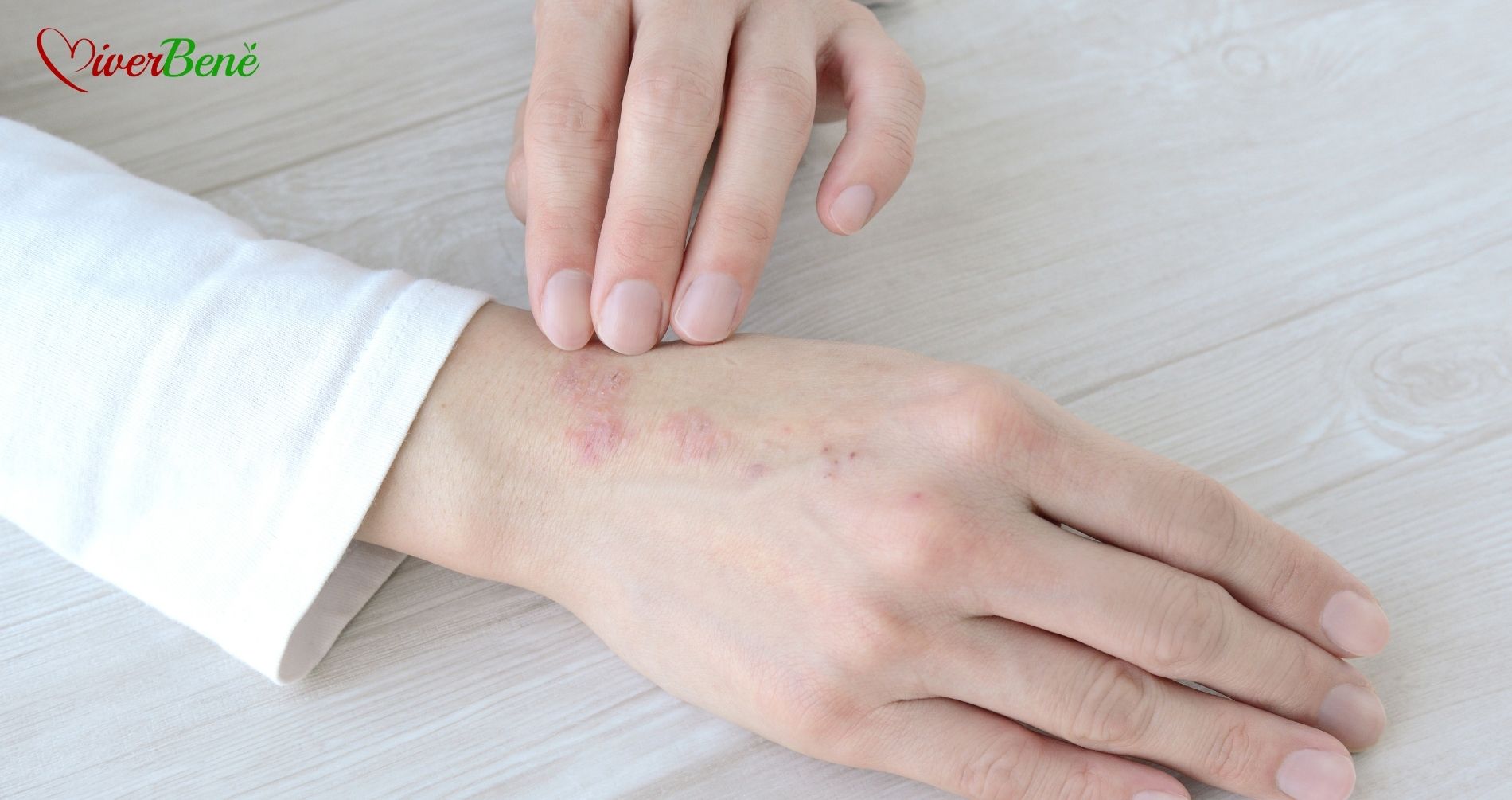 Malattie infiammatorie della pelle: le nuove terapie